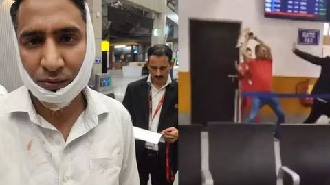 Hindistonda amaldor aeroport xodimlari yuk haqini to&lsquo;lashni so&lsquo;ragani uchun ularning suyaklarini sindirdi (video)