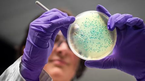 Sun&rsquo;iy intellekt 2 ta superbakteriyaga qarshi antibiotik yaratdi