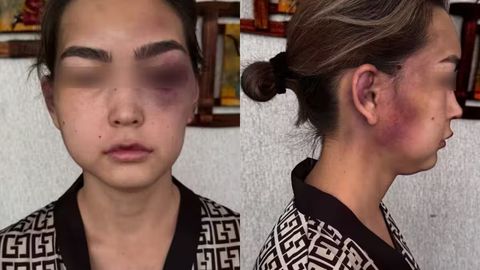 В Сурхандарье мужчина жестоко избил свою жену