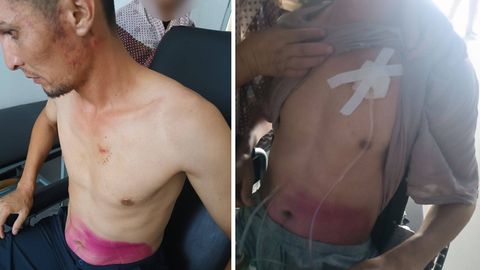 Namanganda fuqaro IIB binosida qiynoqqa solingani yuzasidan jinoyat ishi qoʻzgʻatildi