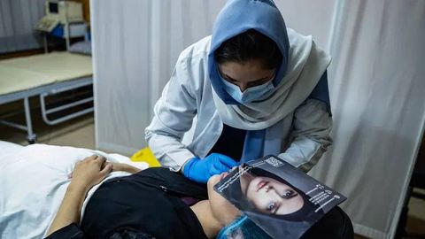 Burqa ostidagi botoks: Afg‘onistonda kosmetologik jarrohlikka talab oshmoqda