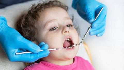 Болаларда кариес: асосий сабаблари, профилактика ва эрта парвариш бўйича мутахассис тавсиялари