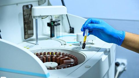 Migrantlarning OIVga tibbiy koʻrikdan oʻtishi ixtiyoriy va bepul — OITSga qarshi kurashish markazi