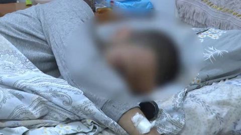 В Ташкенте 24-летний парень лишился части руки из-за пиротехники