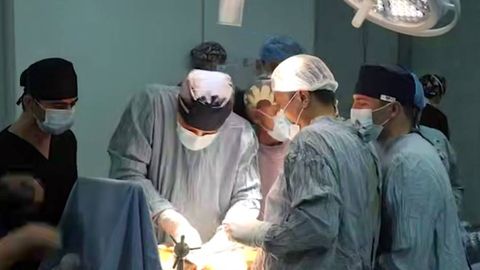 Бухорода биринчи марта жигар кўчириб ўтказиш амалиёти бажарилди