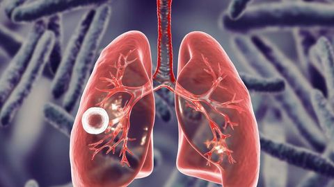 В Узбекистане наладят диагностику туберкулёза с помощью искусственного интеллекта