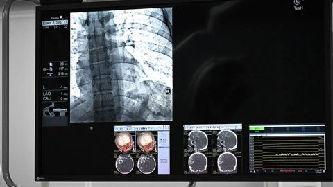 Uzbekistan rolls out AI-supported emergency care for heart and stroke cases