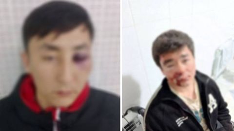 Qashqadaryoda o‘zaro kelishmovchilik oqibatida 3 yigit kaltaklandi