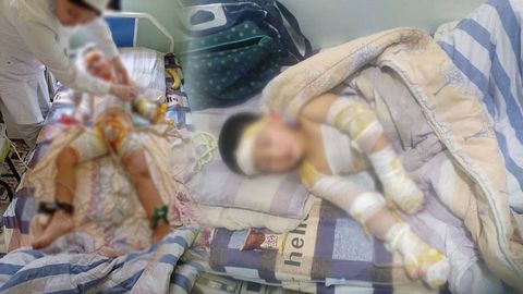 Farg‘onada bog‘chada tok urgan 6 yoshli bola ishi yuzasidan sud-tibbiy ekspertizasi tayinlandi