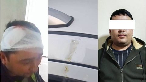 Farg‘onada suv ta’minoti xodimi kaltaklangani yuzasidan jinoyat ishi qo‘zg‘atildi