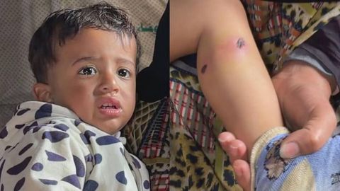 Ғазода 1,5 ёшли бола оёғига сигарет босилиб, қийноққа солинди — ОАВ