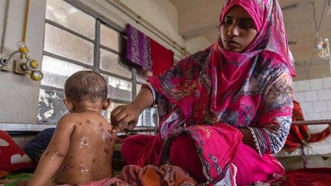 Бангладешда касалликдан 100 га яқин бола вафот этди