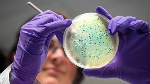 Antibiotiklarga chidamlilik sabab 2050-yilgacha 40 mln kishi o‘lishi mumkin