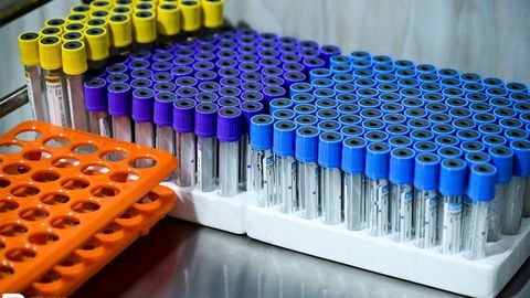 В Узбекистане выросло число случаев менингококковой инфекции среди детей