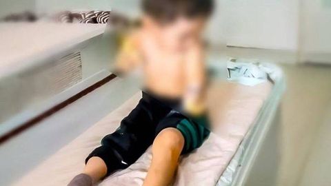 В Минбулаке ребенку ампутировали руки после удара током: хокимият дал официальный комментарий