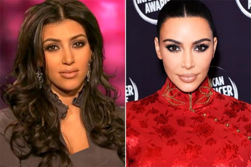 Jennifer Lopes, Kim Kardashyan va 20 yil avvalgidan ko‘ra yaxshiroq ko‘rinishga ega bo‘lgan boshqa yulduzlar (foto)