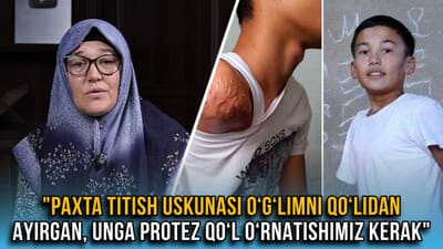 “Paxta titish uskunasi o‘g‘limni qo‘lidan ayirgan, unga protez qo‘l o‘rnatishimiz kerak” — og‘ir sharoitdagi oila xalqdan yordam so‘ramoqda (foto)