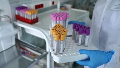 Во всем мире 603 тысячи человек заболели холерой с начала года