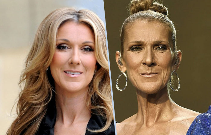 Selin Dion jiddiy tashxisdan keyin qanday yashayapti?