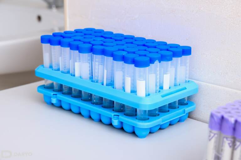 Sanepidqo‘m yangi xavfli virus tarqalgani haqidagi xabarlarni rad etdi 