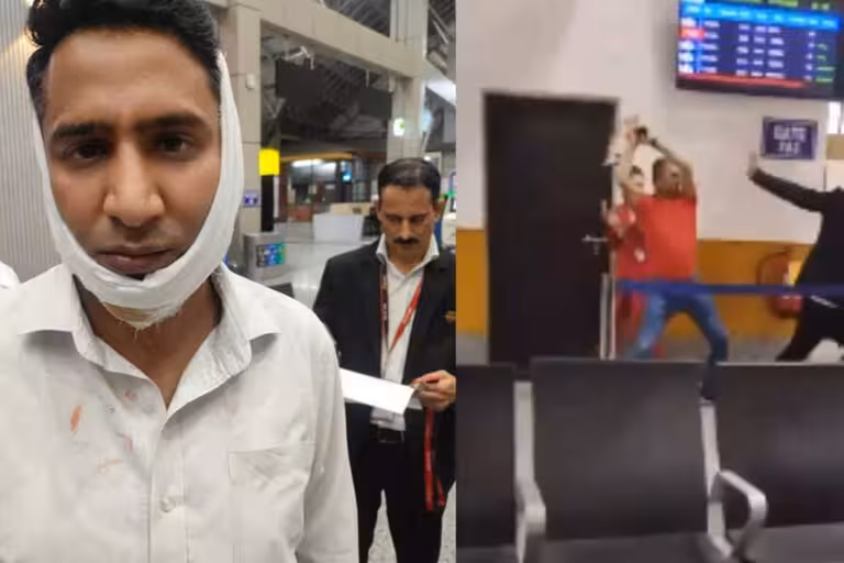 Hindistonda amaldor aeroport xodimlari yuk haqini to‘lashni so‘ragani uchun ularning suyaklarini sindirdi (video)